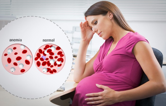 anemia ibu hamil